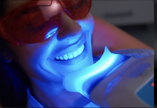 Teeth Whitening