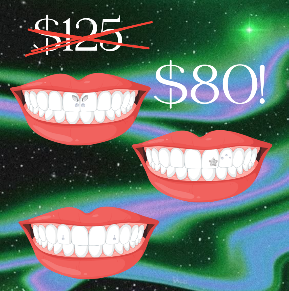 SEPTEMBER TOOTH GEM FLASH SALE!