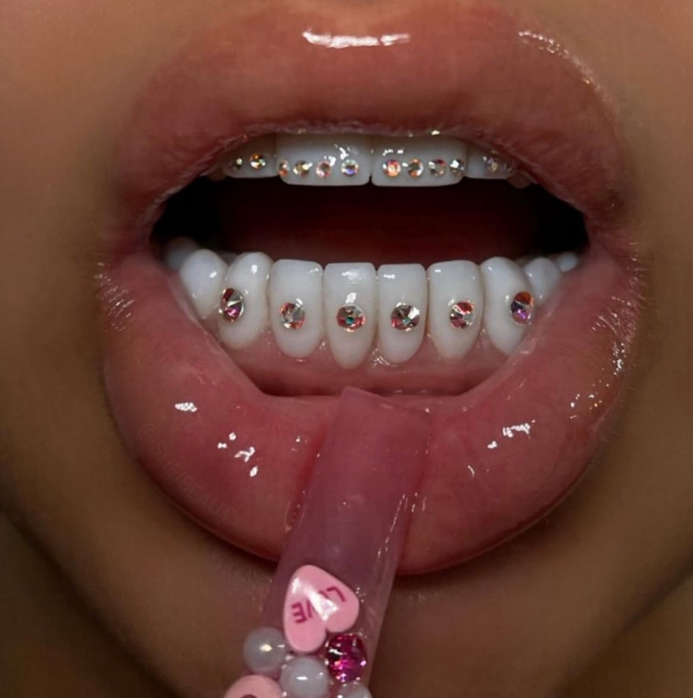 Tooth Gems