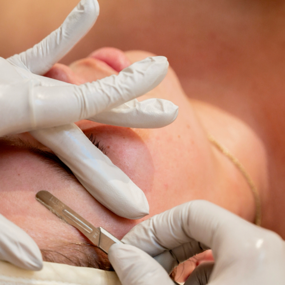 Express Dermaplane Facial at SoulSkin Aesthetics in Niles, MI