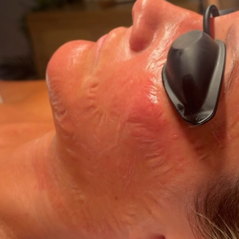 Beyond Botox Facial at Lux South Med Spa in Glennville, GA