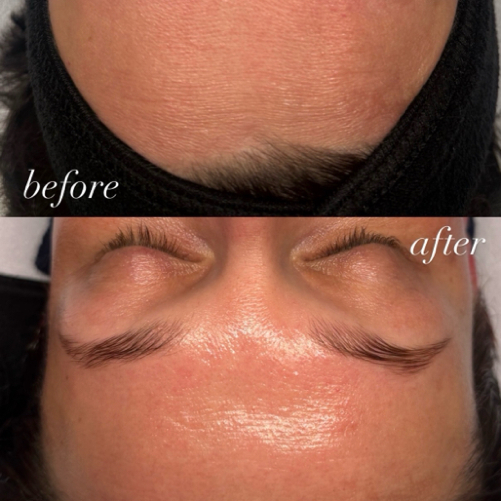 Beyond Botox Facial at Lux South Med Spa in Glennville, GA