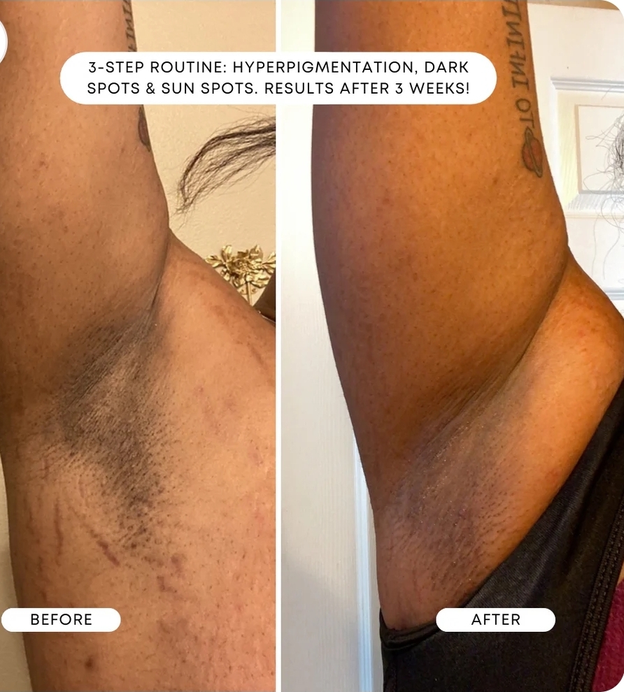 Underarm Wax