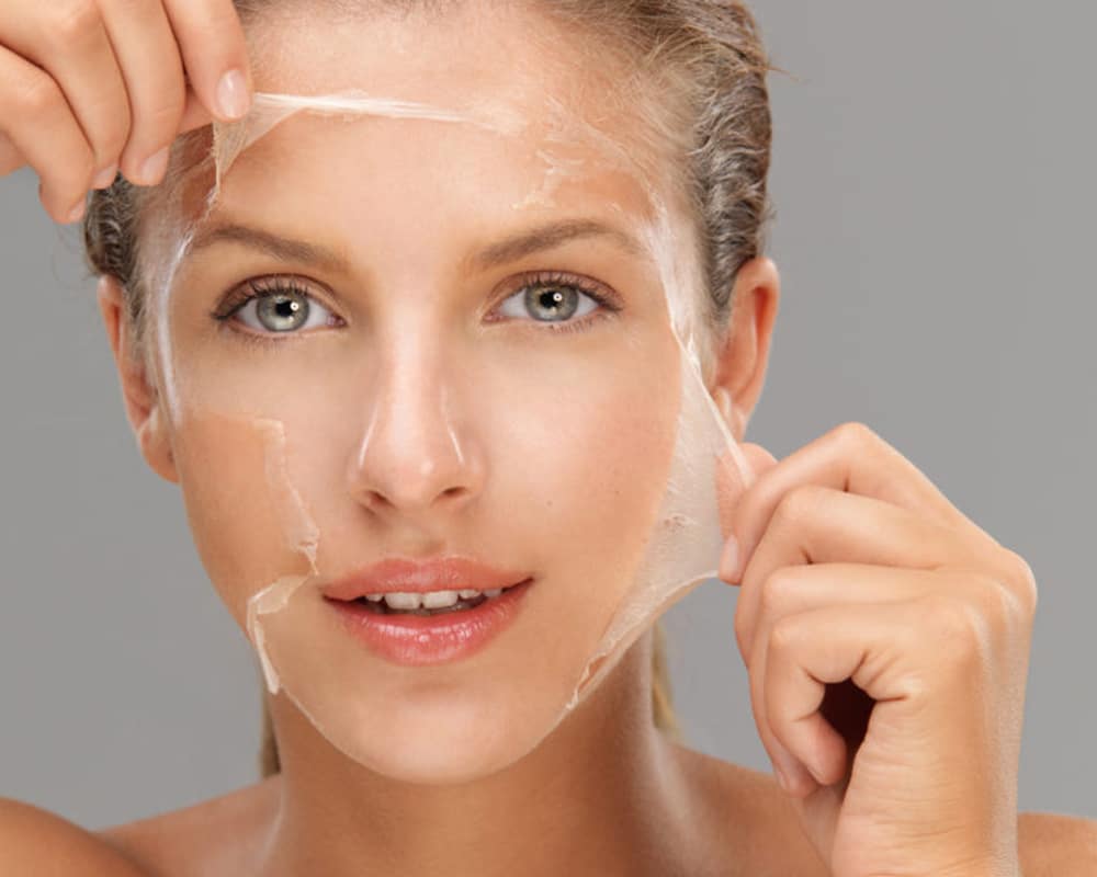 The Chemical Peel Facial