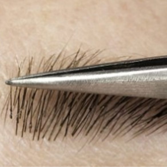 2-4 Week Touch-Up at Rose & Balance Skin Studio in San Diego, CA