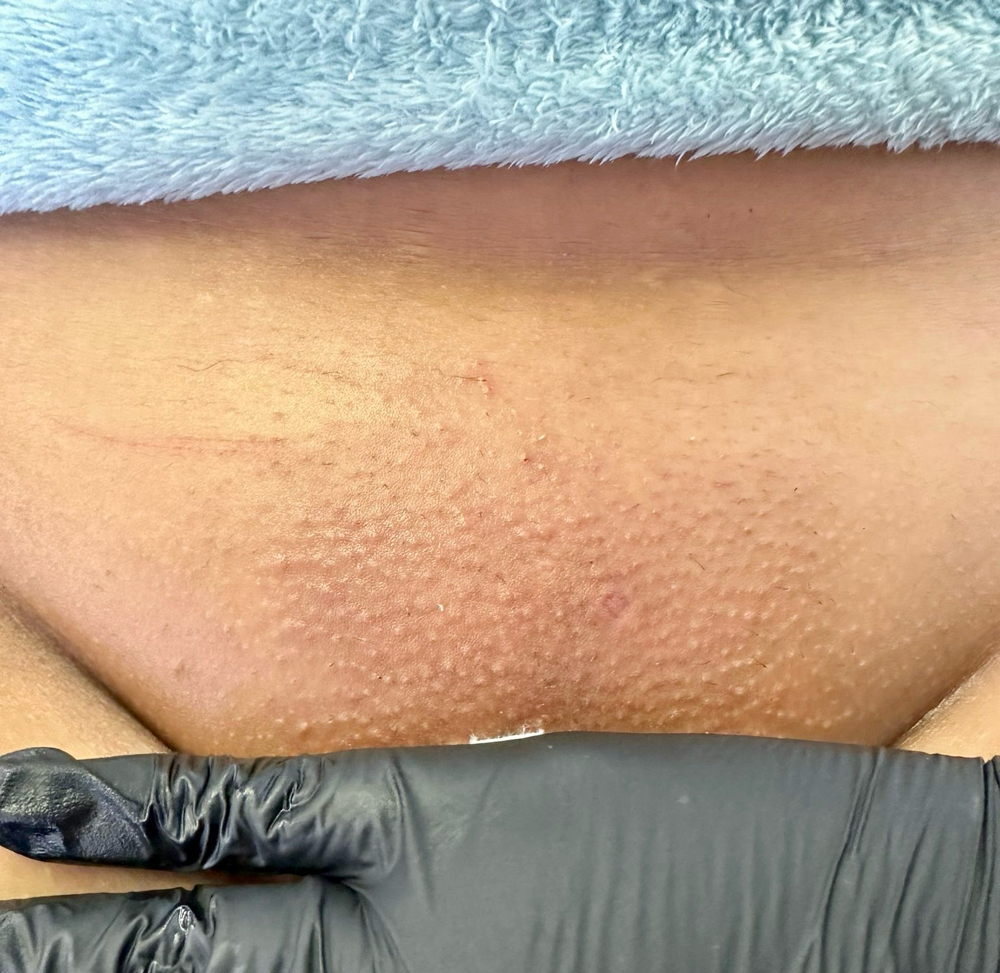 Brazilian Wax