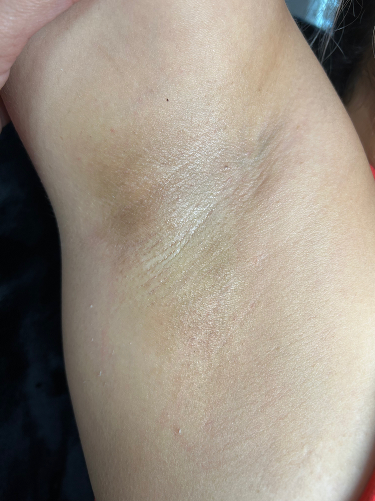 Underarms Wax