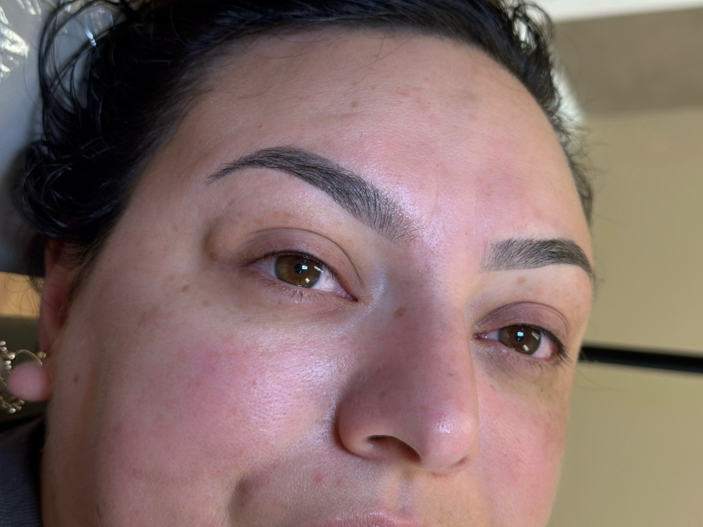 Lash Enhancement