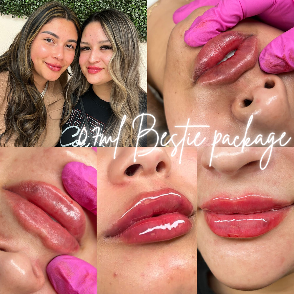 0.7ML Bestie Package👯‍♀️ at BeautyHolic Aesthetics LLC in Lubbock, TX