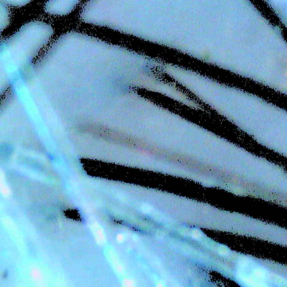 Scalp Analysis With Micro Cameamera at Southern Suites in Blanchard, OK