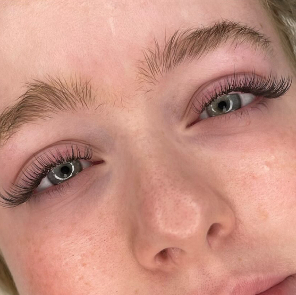 Mini Fill In at Elle Grace Aesthetics in Maryville, TN