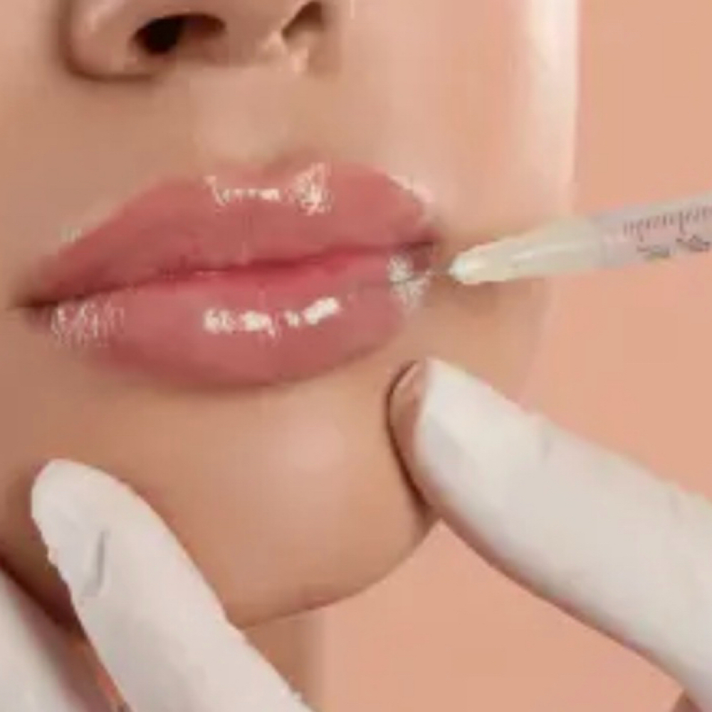 Dermal Fillers at Lyla James Aesthetics and Wellness in Pryor, OK