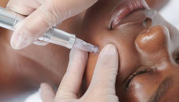 Nano Infusion at Shay’s Peaceful Escape, LLC in San Antonio, TX