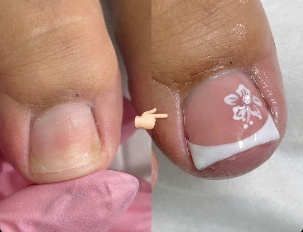 Pedicure add on: TOE FIX