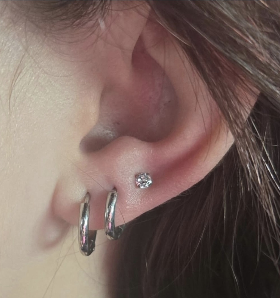 Ear Lobes Over Age 10