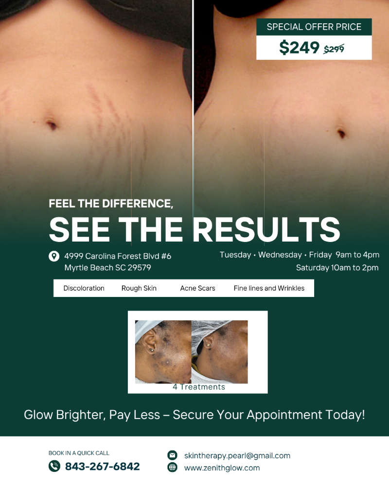 Holistic Microneedling