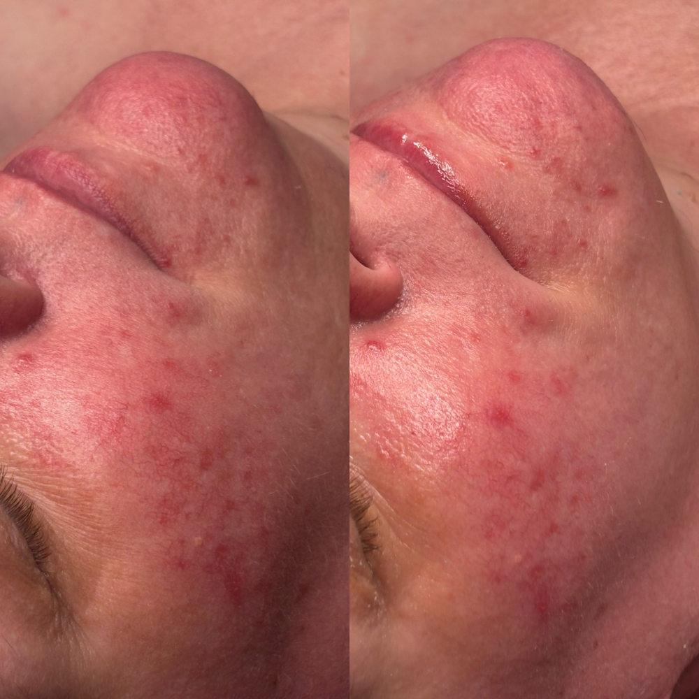 Soothe & Shield