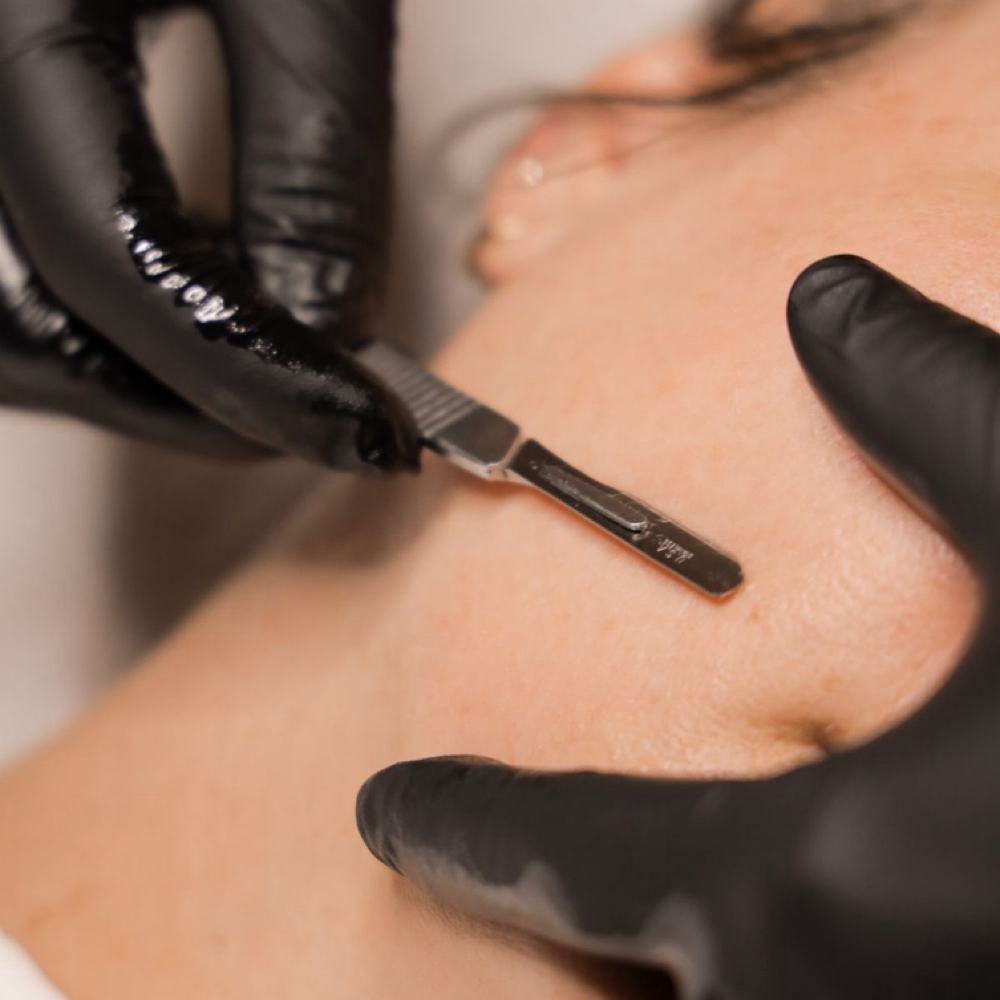 DERMAPLANE FACIAL at LISETTE MAKEUP - 11:11 ESTHETICS in Wyandotte, MI