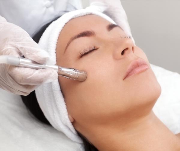 Microdermabrasion Facial