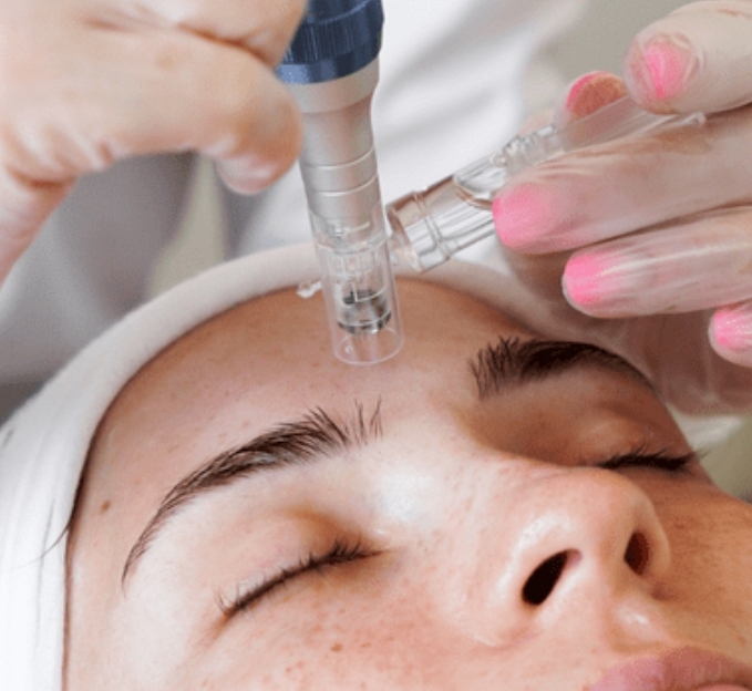 Collagen Induction Spot Treatment at Gina Schober Esthetics in 91750