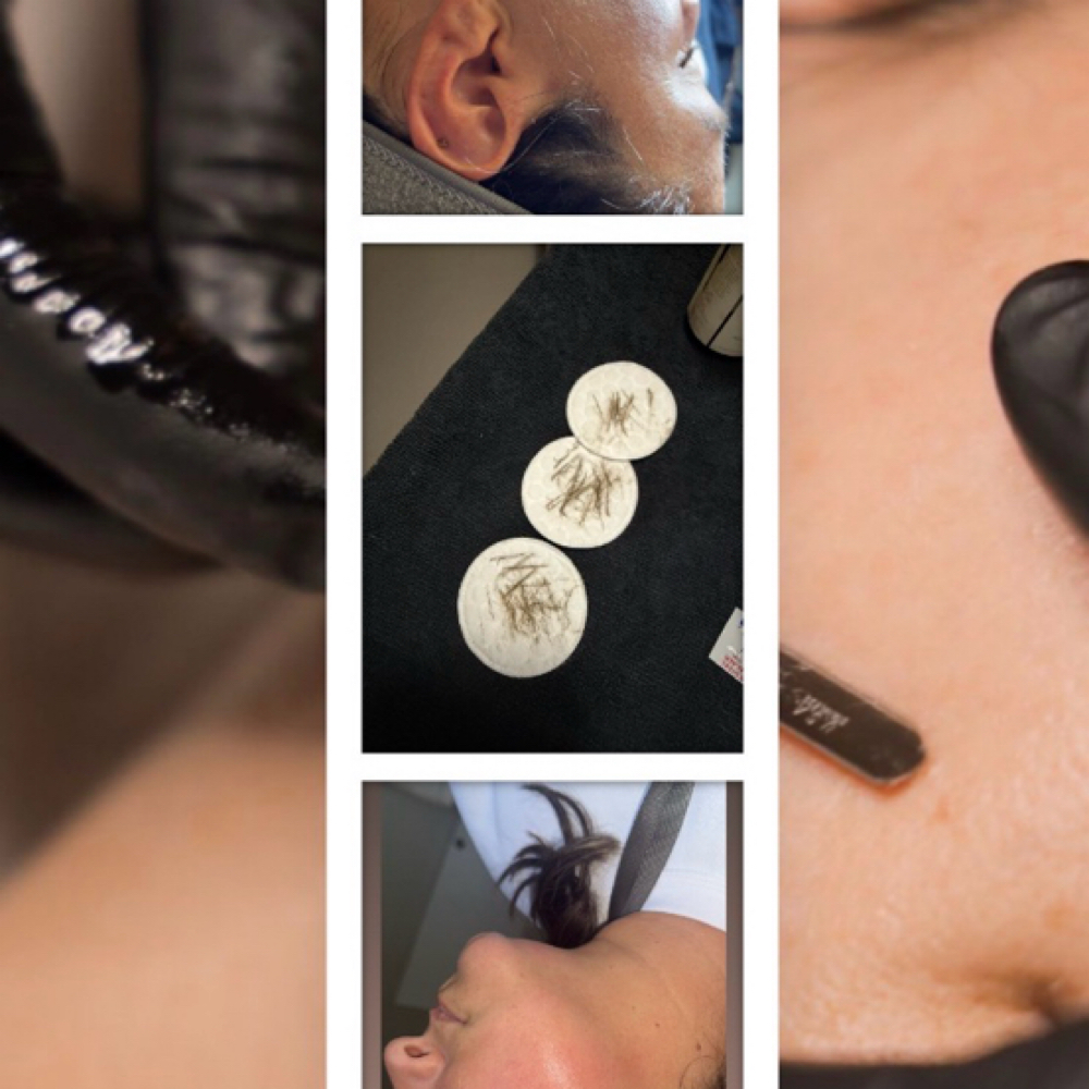 The Ultimate Glow Facial at Honey Spa in Thibodaux, LA