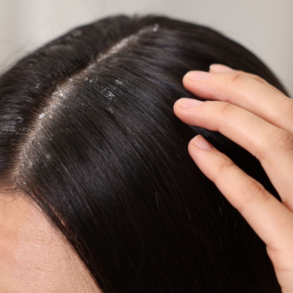 Scalp Treatment