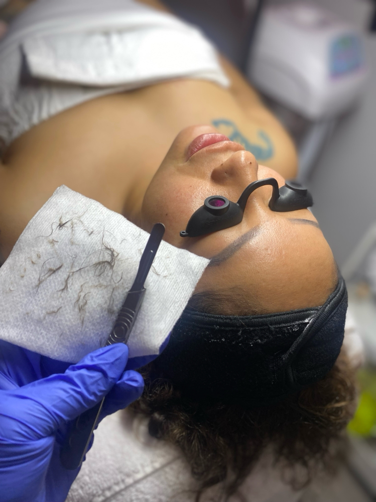 Dermaplane Facial