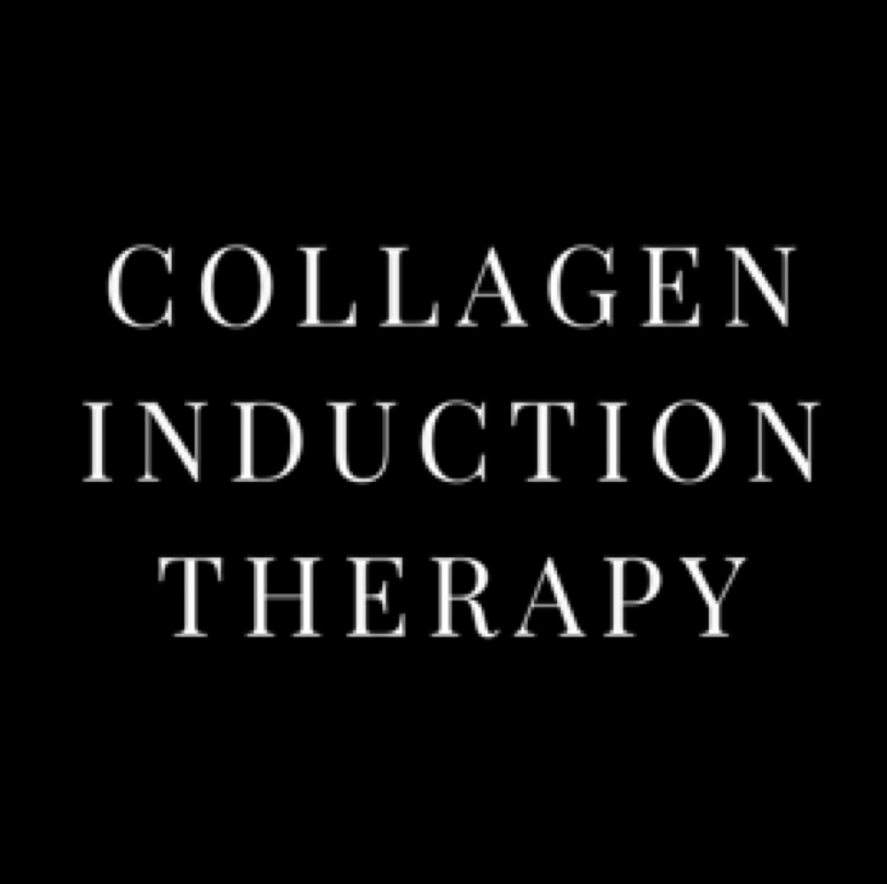 ProCell MD Microchanneling at Inspire Skincare LLC. in North Andover, MA