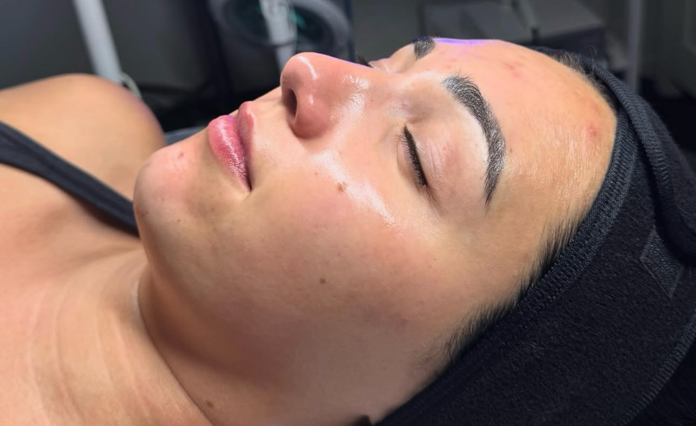 Peel + Best Of Both Worlds