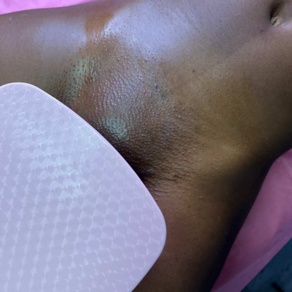 Brazilian Hard Wax at GlorgeousSkinn Aesthetics in Houston, TX