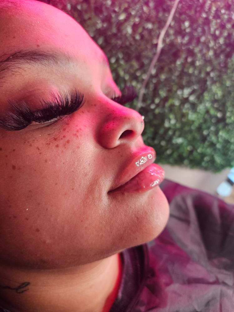 Lip Filler 1ML( Signature Lips)👄