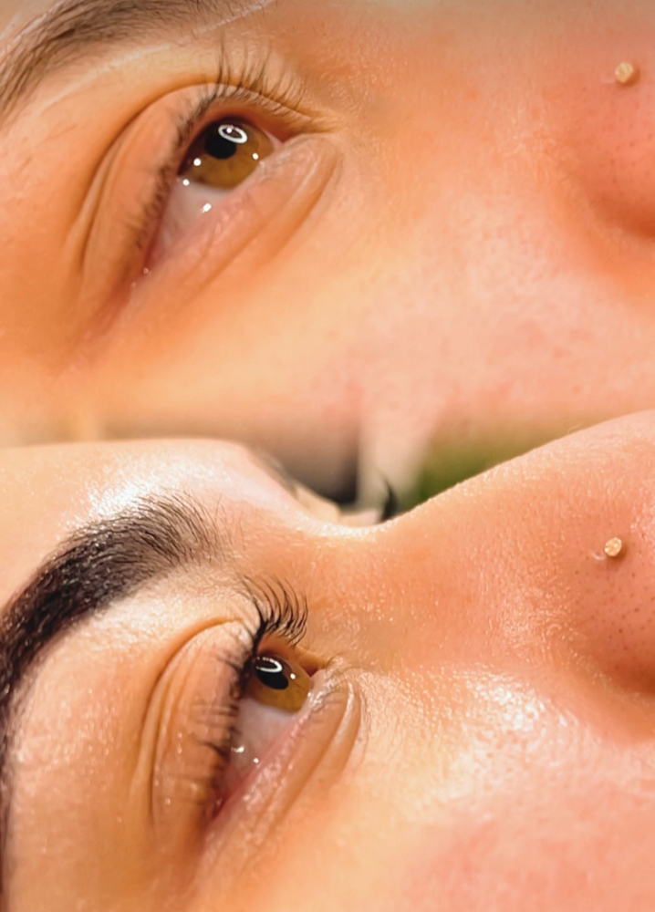 Lash Lift