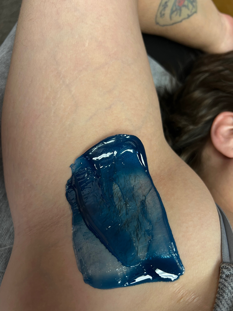 Underarm