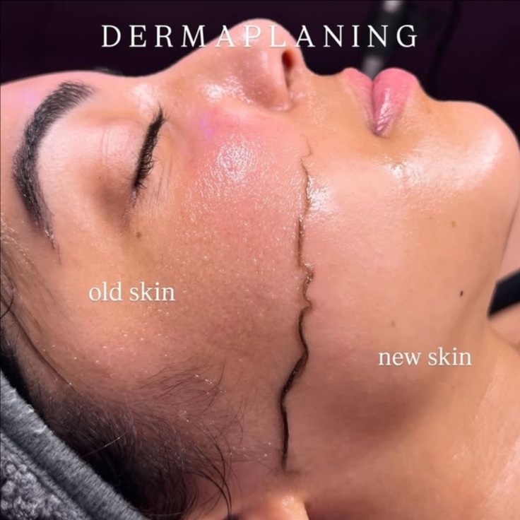 Dermaplaning Glow Ritual at Xo Nail Salon in Watseka, IL