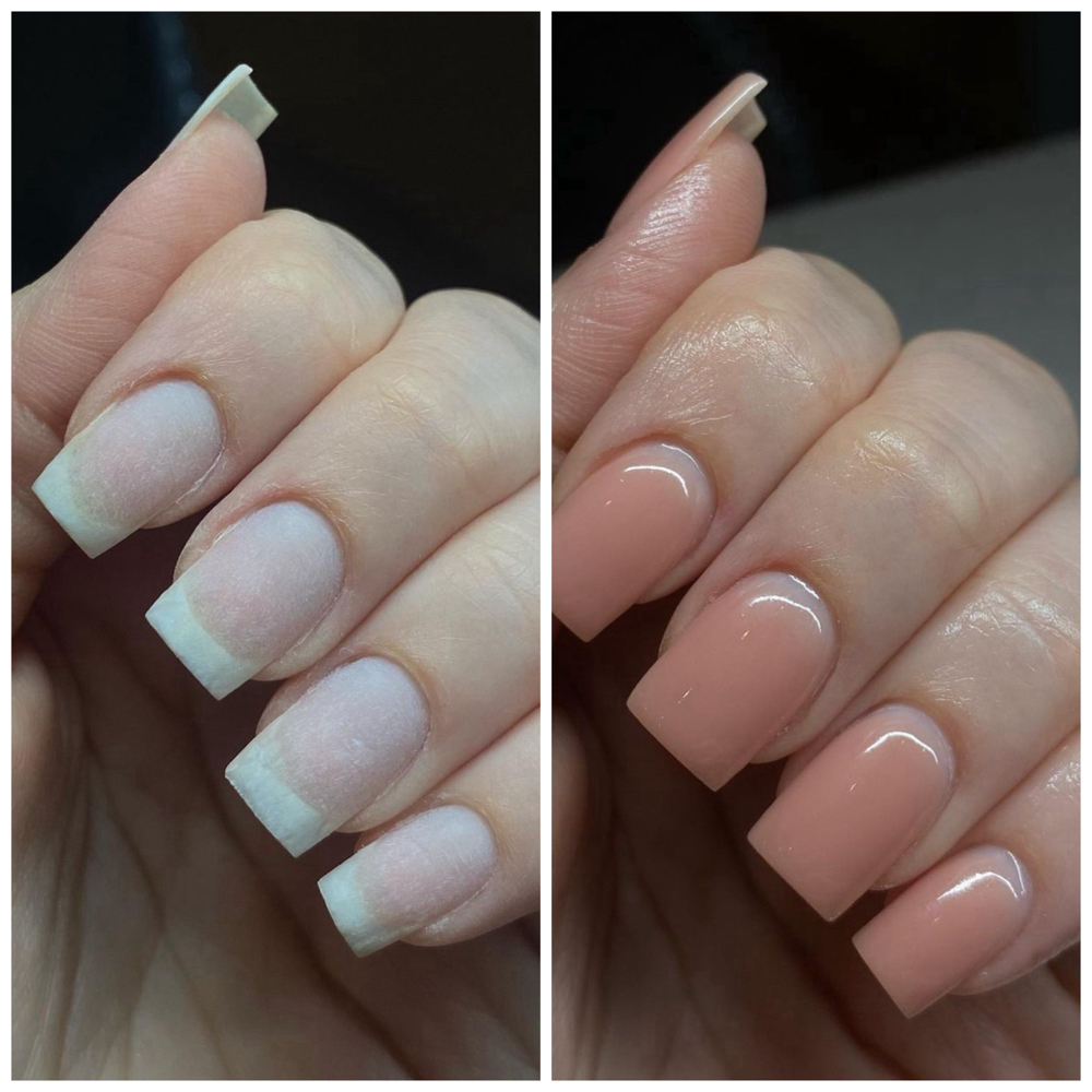 Acrygel Overlay