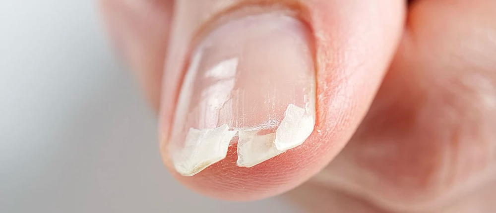 Nail-Repair (Add On)