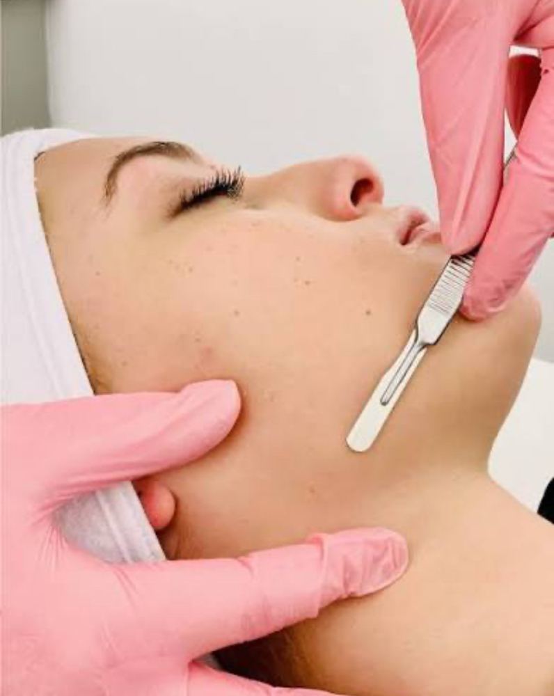 Dermaplane Facial