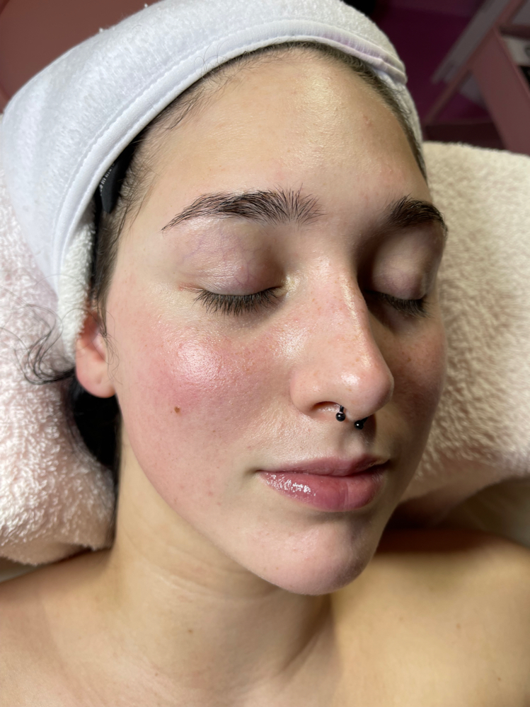 Customized  Facial