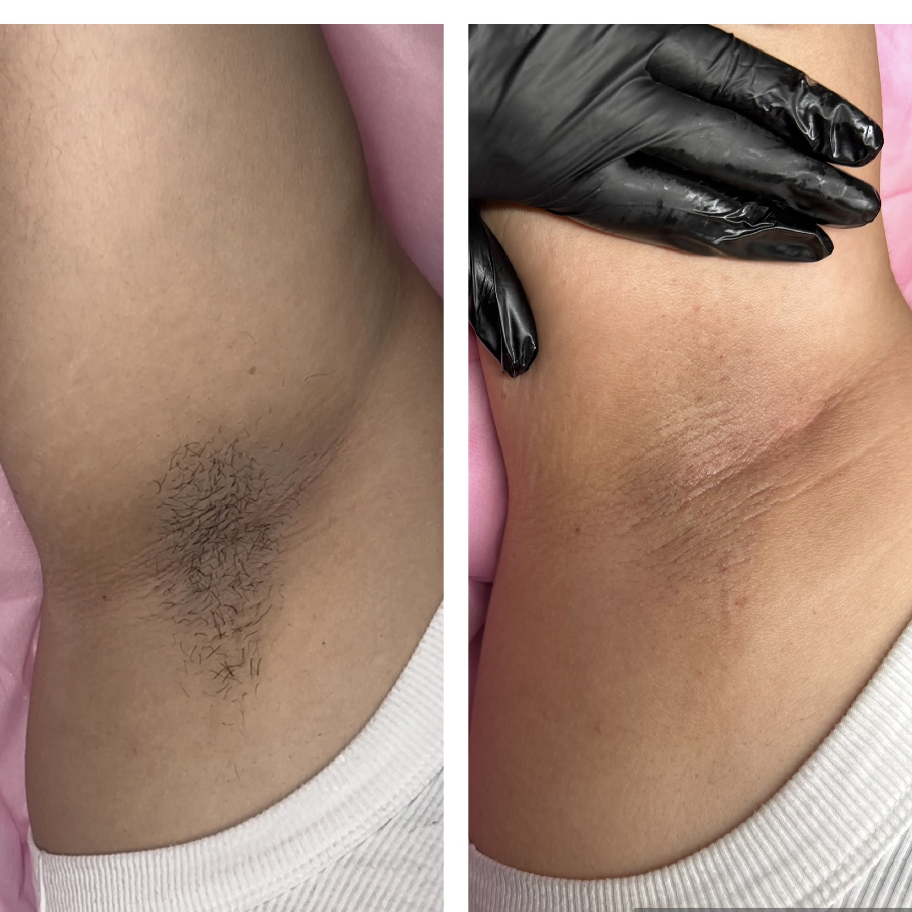Underarm Wax