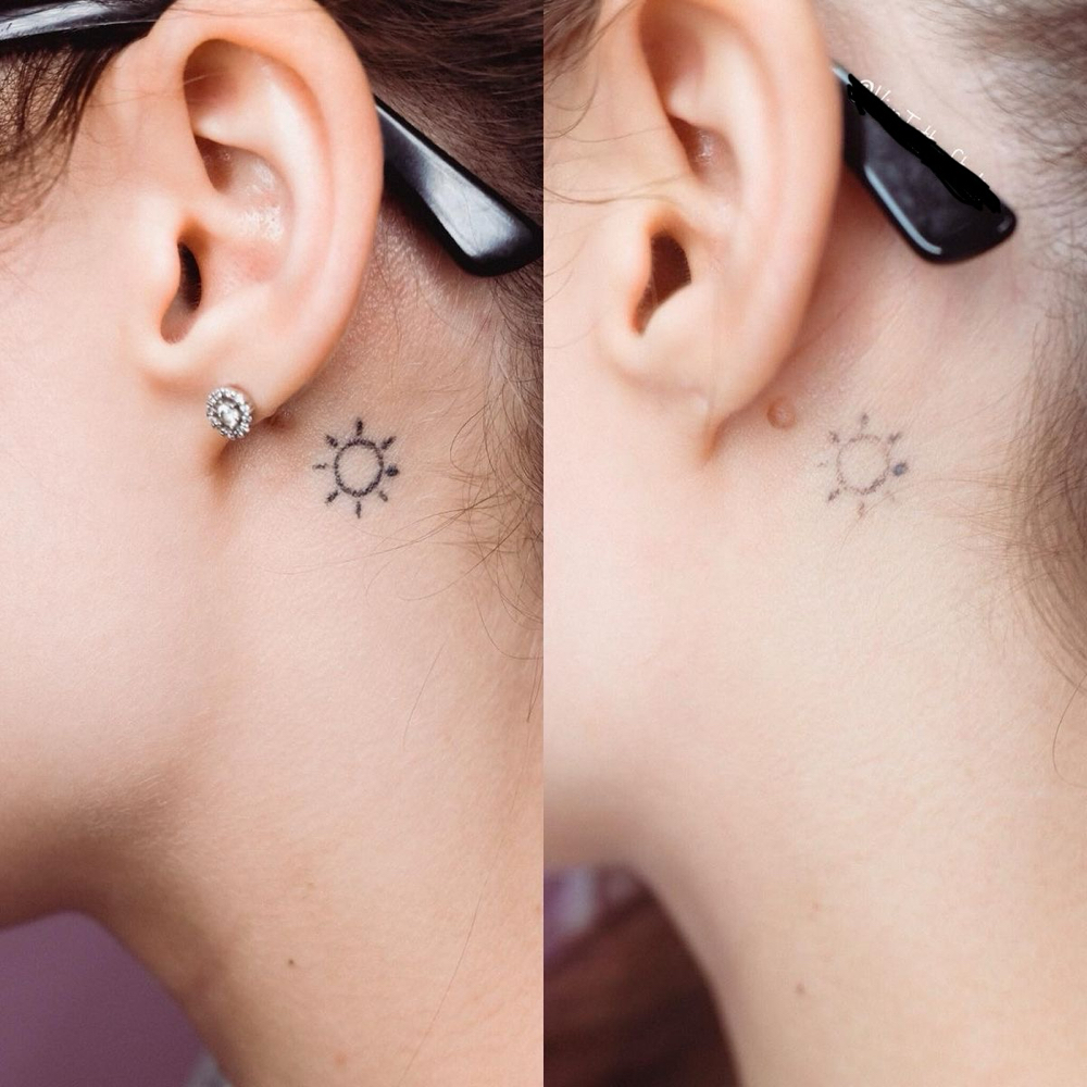 Laser Tattoo Removal at Madame L Beauty Studio in Downers Grove, IL