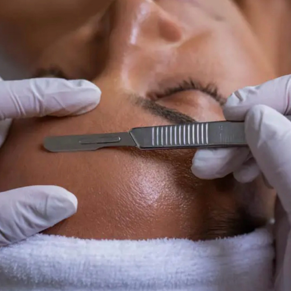 Dermaplane Add On To Facial at Gina Schober Esthetics in 91750