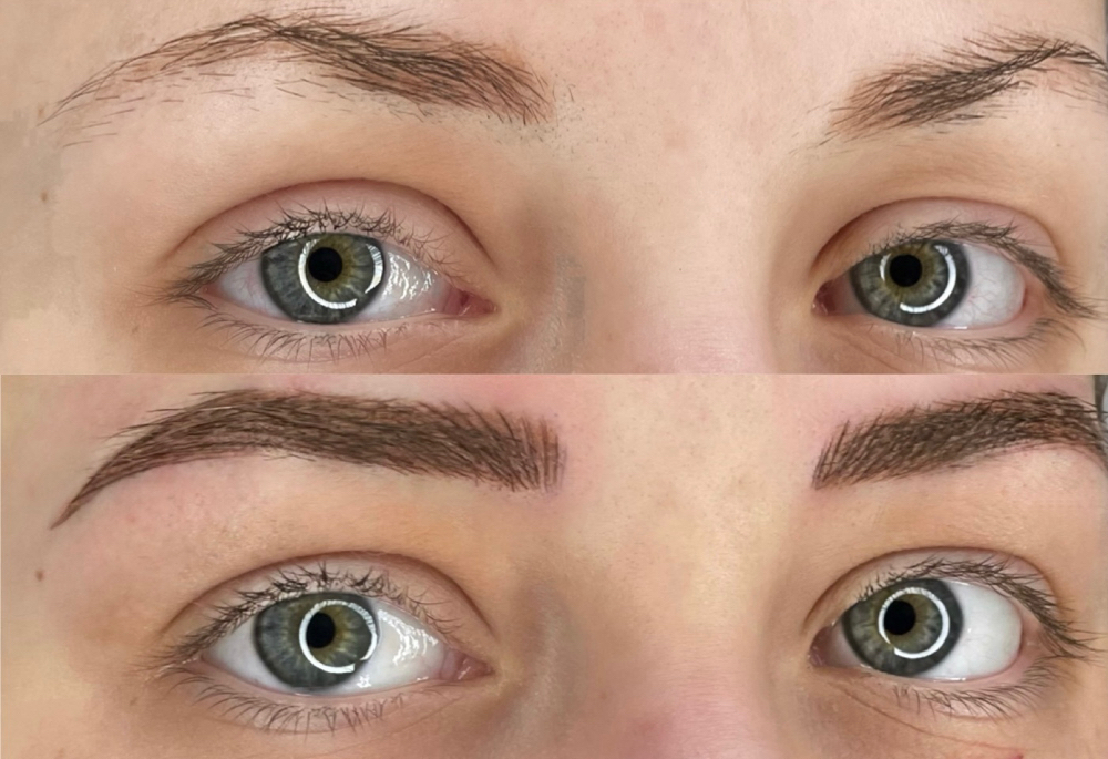 Brow Consult