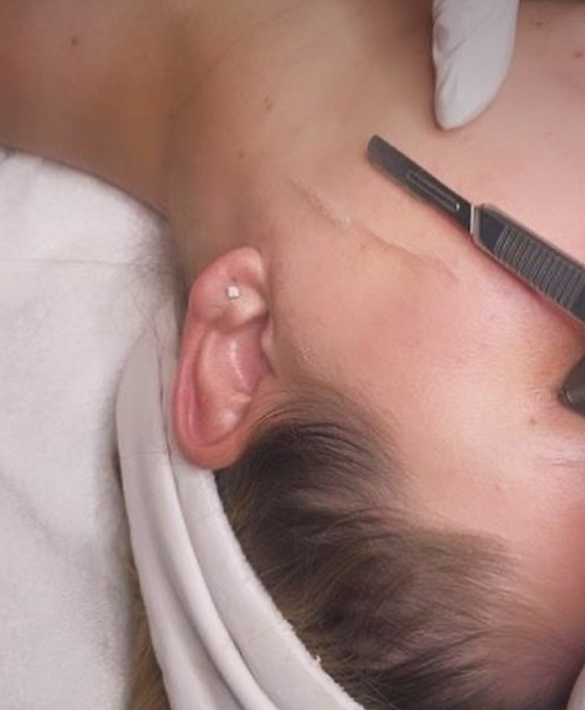 Dermaplane (No add-ons)