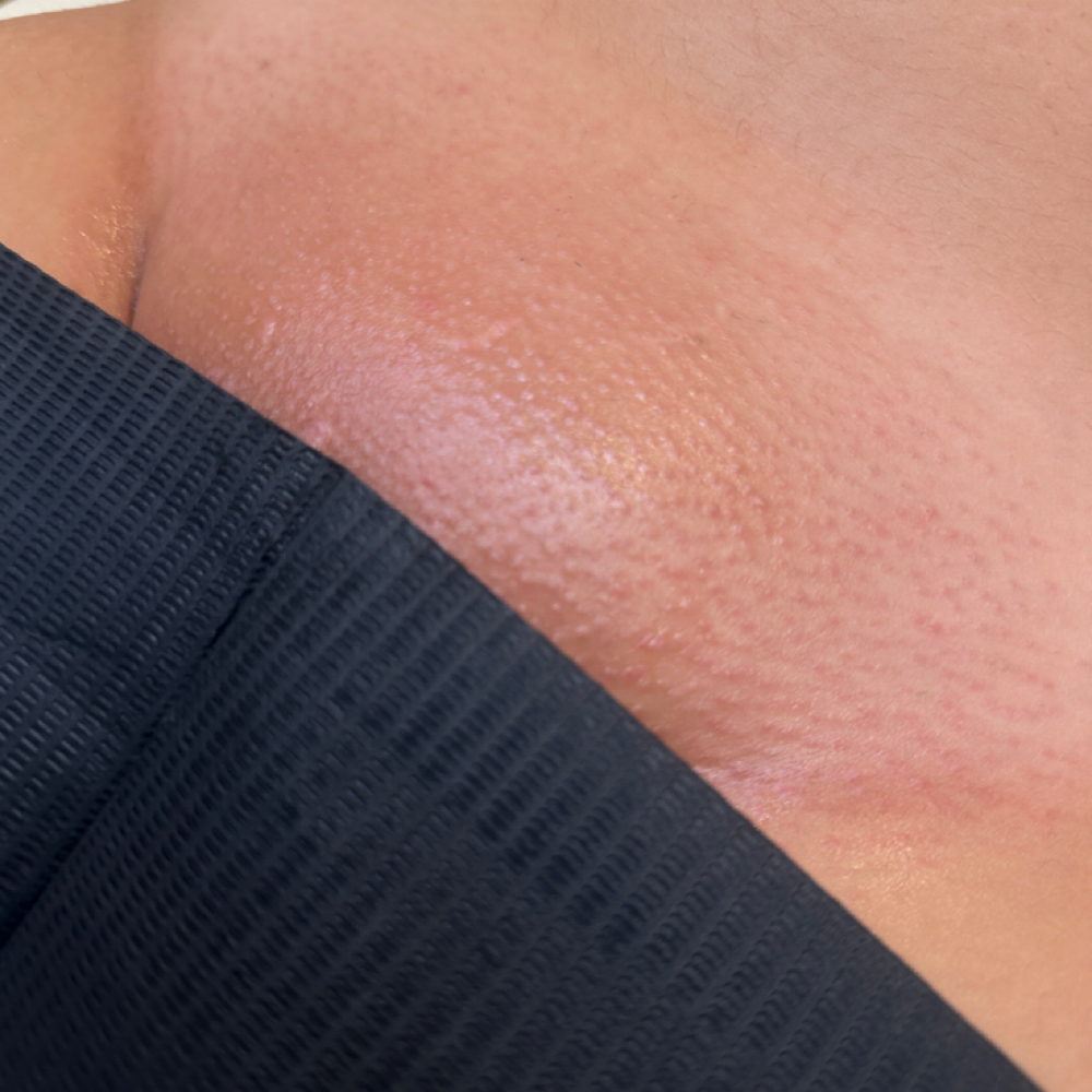 Returning Client Brazilian at aestheticswliz in Fontana, CA