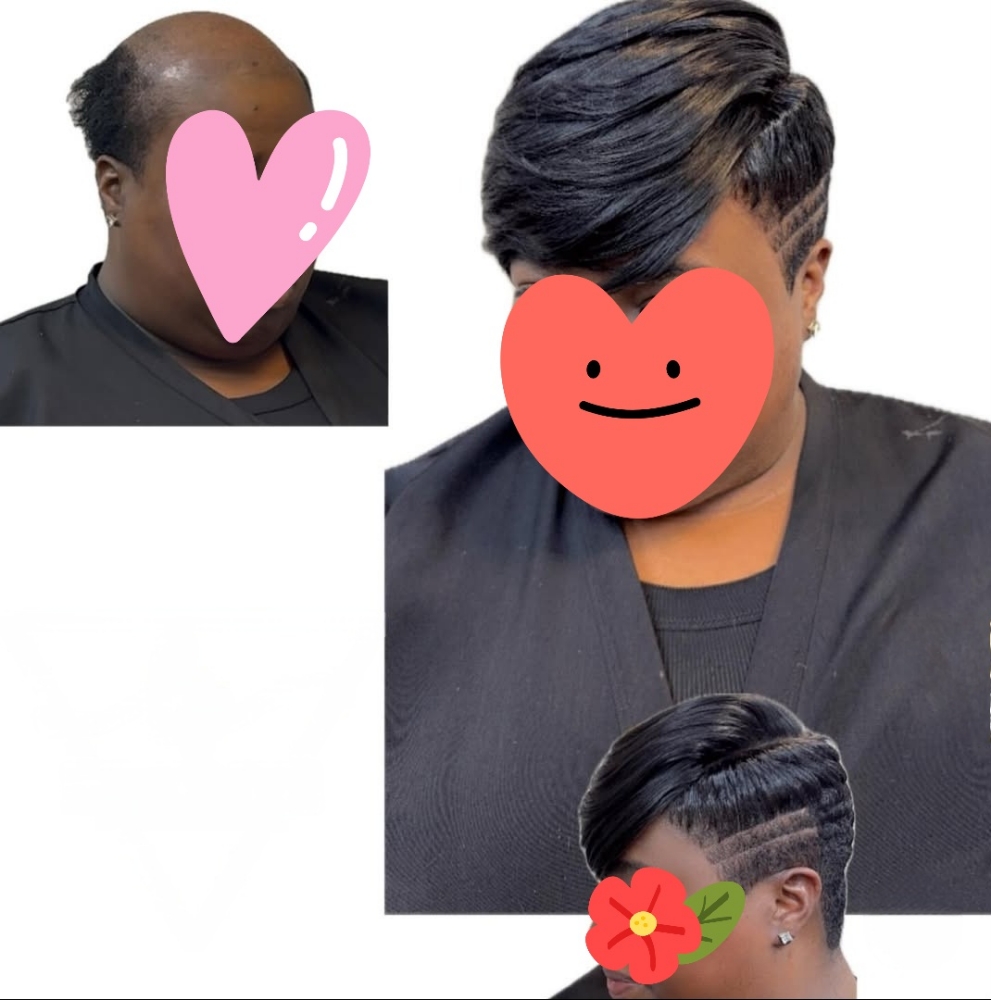 Non-Surgical Hair Loss Replacements