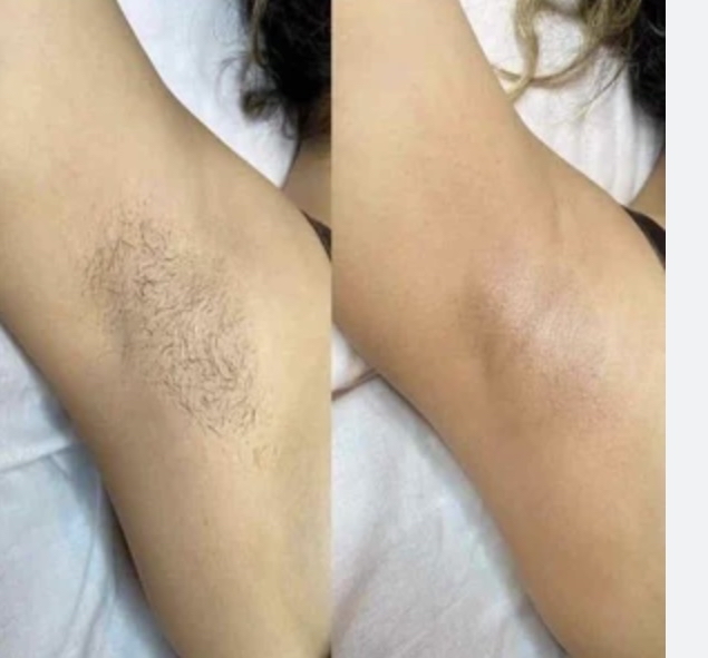 Underarms Wax Women