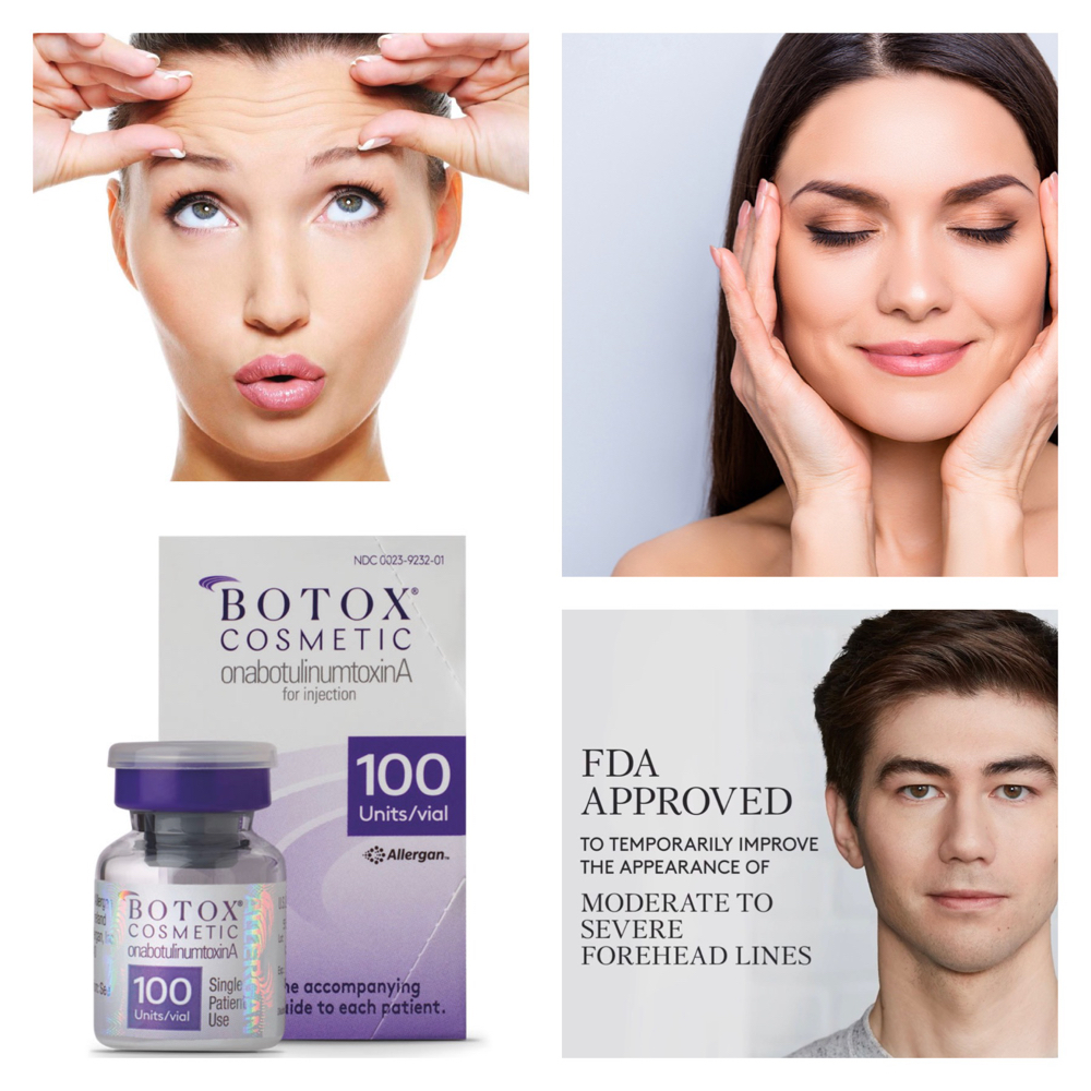 Botox, Full Face (40 or more units)