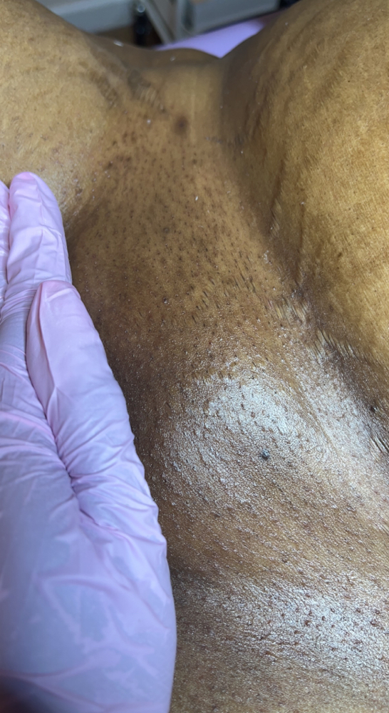 Brazilian Wax Wednesdays