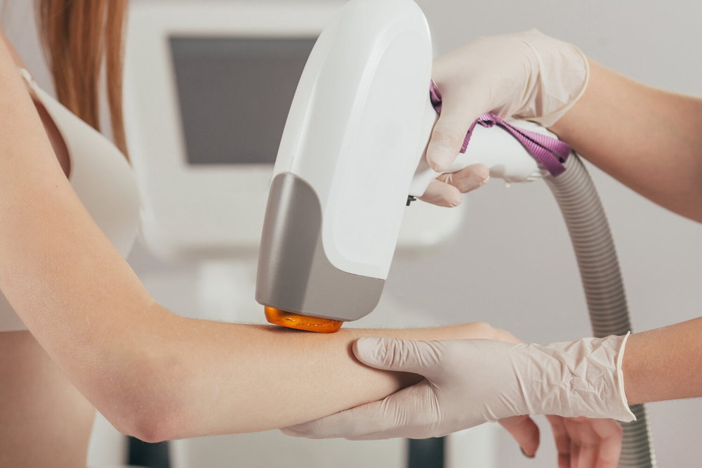 Laser Hair Removal: Arms