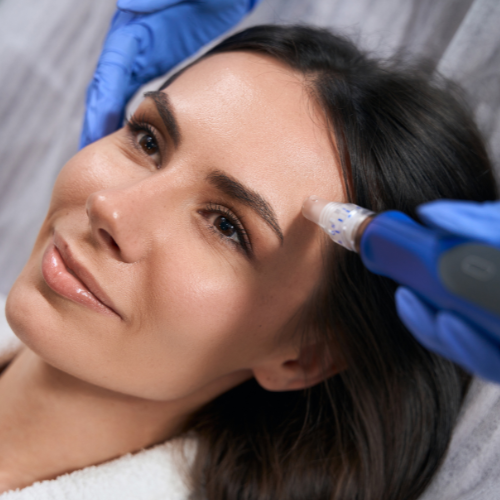 Nano-needling